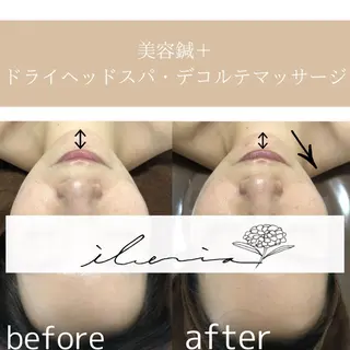 心斎橋痩身ダイエット 韓国.美容鍼.小顔のエステ・リラクイメージ