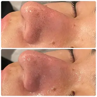 yellow.所属・yellow💛【 脱毛&フェイシャル】のエステ・リラクイメージ