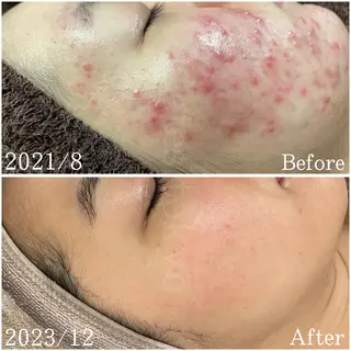 etes （エトエス）所属・etes.tokyo 中目黒のエステ・リラクイメージ