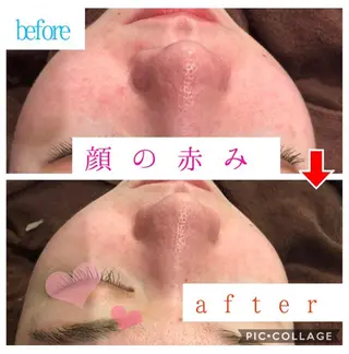 ロング カラー パーマ ヘアアレンジ メンズ キッズ ネイル マツエク・マツパ 四つ星サロン🎖 腸＆ニキビケアに特化のエステ・リラクイメージ