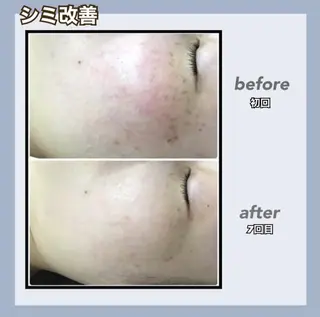 RAYVIS 郡山店のエステ・リラクイメージ