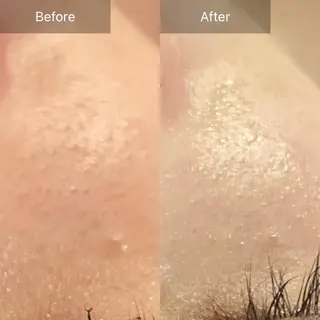 Mandarin Orange所属・毛穴から始める肌メン テマンダリンオレンジのエステ・リラクイメージ