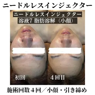 トータルビューティー サロンSalaのマツエク・マツパデザイン