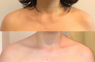 yomo  me!　黄土漢方蒸し&ビソンテラピー所属・yomo me! ヨモミーのエステ・リラクイメージ