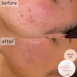 アンテインチル 山本のエステ・リラクイメージ