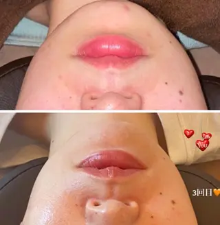 ■超絶小顔&肌管理室■所属・🦋整形級の究極美顔 本格韓国式小顔🦋のエステ・リラクイメージ