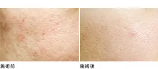 Non ビューティサロンのエステ・リラクイメージ