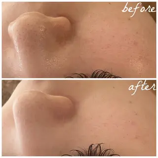 メンズ メナード岐阜茜部 杉浦のエステ・リラクイメージ