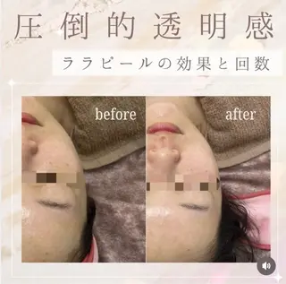 看護師が施術する ナスサロ/Emi🪽のエステ・リラクイメージ