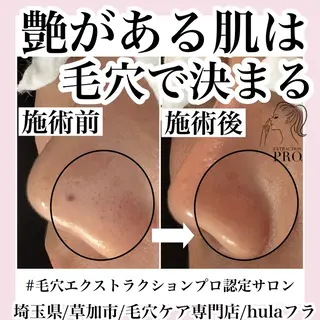 毛穴専門店hula 杉山智美のエステ・リラクイメージ