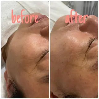 アルカンジュ~archange~所属・痩身/毛穴洗浄/脱毛 アルカンジュのエステ・リラクイメージ