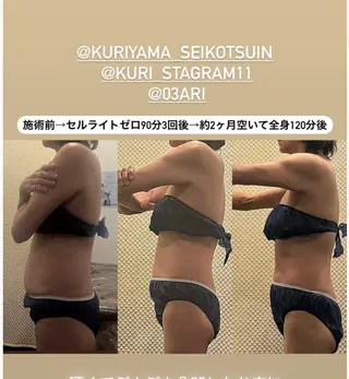 Bodyリカバリー栗山整骨院所属・Arisa✨老廃物や 脂肪をお掃除💪のエステ・リラクイメージ