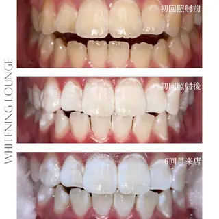 ホワイトニングラウンジ横須賀所属・ホワイトニング Lounge横須賀のその他イメージ