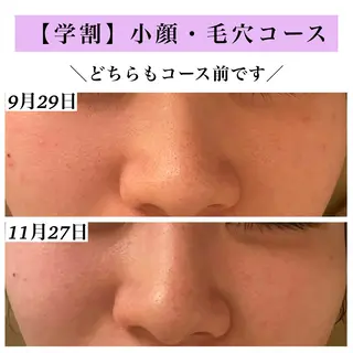 Bellesthe (ベルエステ)のエステ・リラクイメージ