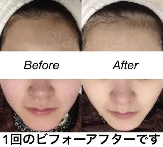 ミディアム カラー パーマ ヘアアレンジ キッズ ネイル マツエク・マツパ 都度払い肌質改善 &脱毛Blancheのエステ・リラクイメージ