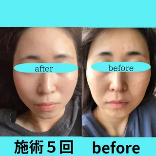 岩田 朝美の眉毛・アイブロウイメージ