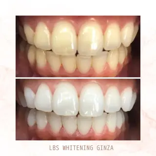 メンズ LBSホワイトニング 銀座店💎店長浦和のその他イメージ