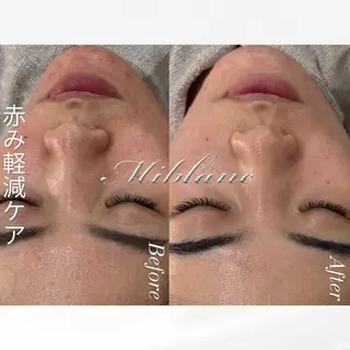 肌質管理 MIBLANC上野店のその他イメージ