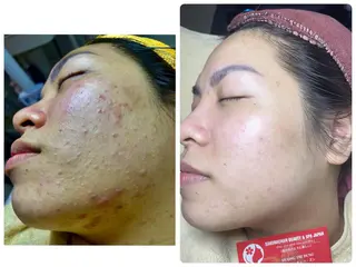 ニキビ、痩身、脱毛、 サクラチャンスパのエステ・リラクイメージ