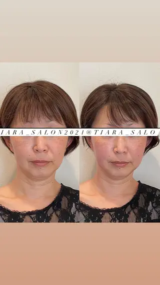 セミロング カラー パーマ ヘアアレンジ メンズ キッズ ネイル マツエク・マツパ アイブロウ 美容鍼灸サロン　TIARA所属・鍼灸サロン TIARA　美容鍼のエステ・リラクイメージ