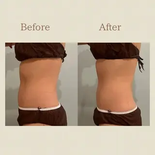 お腹痩せエステ Flat BELLY 恵比寿所属・【腸もみ/脂肪冷却】 お腹エステ/恵比寿のエステ・リラクイメージ