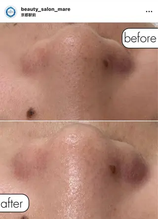 Beauty Salon MARE所属・ビューティーサロン MAREのエステ・リラクイメージ