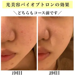 Bellesthe (ベルエステ)のエステ・リラクイメージ