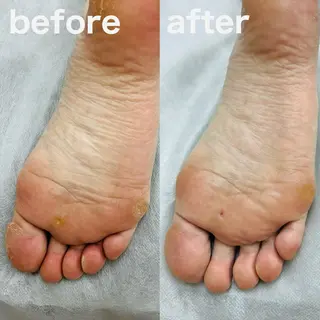 巻き爪フットケアサロンKotori所属・フットケアサロン Kotoriのその他イメージ