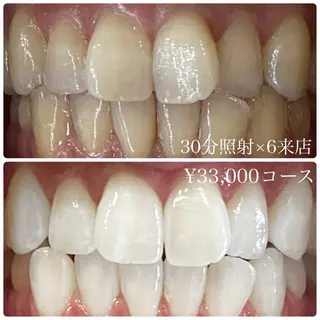 PLATINUM Beauty 横浜店所属・ホワイトニングルーム 横浜店のその他イメージ