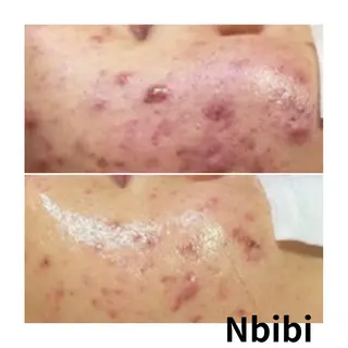 韓国🇰🇷価格 サロン_Nbibiのエステ・リラクイメージ