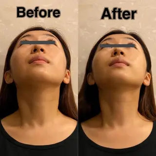 姿勢・骨盤/小顔矯正 痩身ダイエット 横田のエステ・リラクイメージ