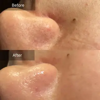 Mandarin Orange所属・毛穴から始める肌メン テマンダリンオレンジのエステ・リラクイメージ