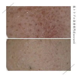 ロング カラー パーマ ヘアアレンジ メンズ キッズ ネイル マツエク・マツパ アイブロウ 触れたくなる モテ肌へ...❤︎のエステ・リラクイメージ