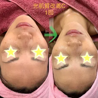 Lien オーナー 山口智嘉のエステ・リラクイメージ