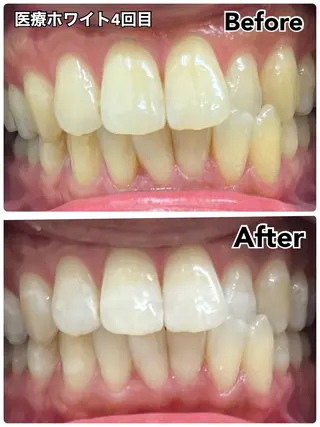 SELFMADE 高崎店の眉毛・アイブロウイメージ