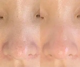 メンズ salonLADYSTYLE所属・稲嶺 美華のエステ・リラクイメージ