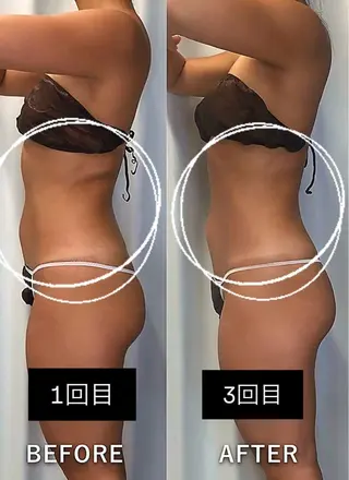 美容整体・塗る漢方・フェイシャルRechica所属・心斎橋痩身 美容整体×肌管理のエステ・リラクイメージ