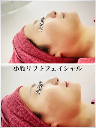 Chalon所属・REVI取扱・肌悩み 毛穴Chalonのエステ・リラクイメージ