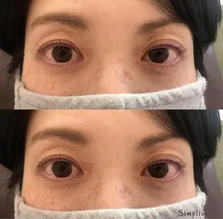 マツエク・マツパ simpliee / arisaのネイルデザイン