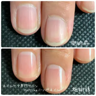 ネイル ケアが得意なサロン Happinailのエステ・リラクイメージ