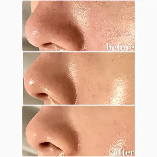 Lily branc 痩身/小顔/肌質改善のエステ・リラクイメージ