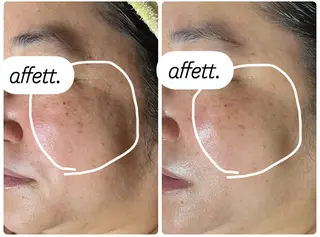 肌質改善&アロマサロンaffett.所属・澤井 千晴のエステ・リラクイメージ