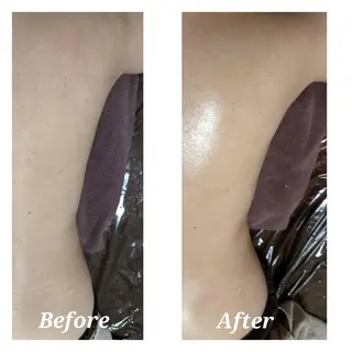 整体エステ　NEW ME所属・深層リンパオイル/小 顔とドライヘッドスパのエステ・リラクイメージ