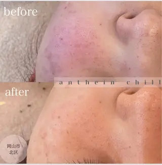 アンテインチル 山本のエステ・リラクイメージ