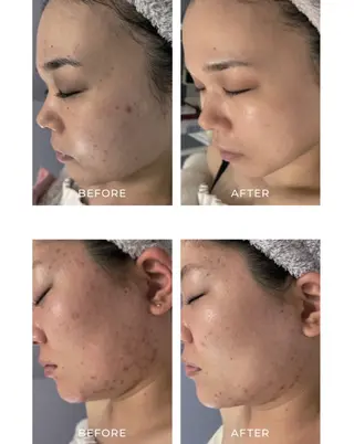 Luca所属・Luca ﾙｶのエステ・リラクイメージ