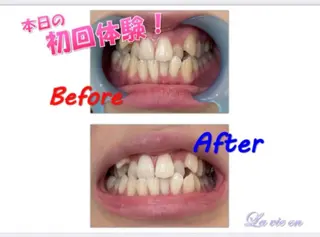 セルフホワイトニングサロン　ラヴィアン所属・ホワイトニングサロン La vie enのその他イメージ