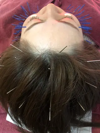 美容鍼灸女性専用 りんご鍼灸治療院のその他イメージ