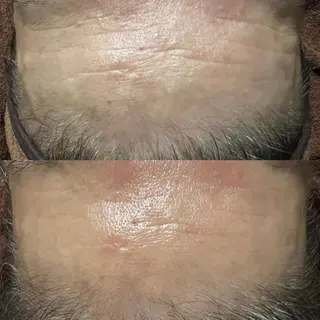 lymph care 'Welnəsのエステ・リラクイメージ