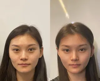 マツエク・マツパ aliaハイフ&水光ジェットサロン所属・aliaハーブ水光店 エステティシャン募集のエステ・リラクイメージ