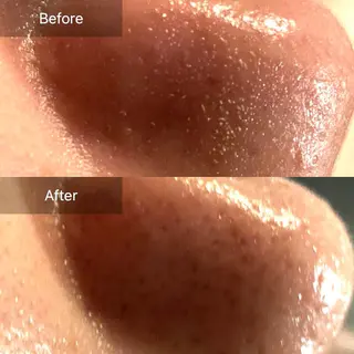 Mandarin Orange所属・毛穴から始める肌メン テマンダリンオレンジのエステ・リラクイメージ